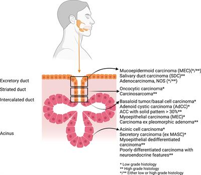 Salivary gland cancers in elderly patients: challenges and therapeutic strategies